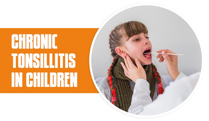 Chronic Tonsillitis in Children