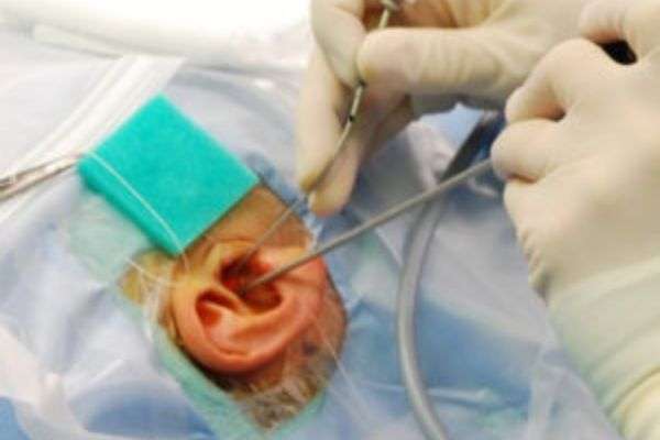 Ear-Surgery