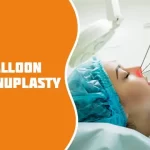 Balloon Sinuplasty